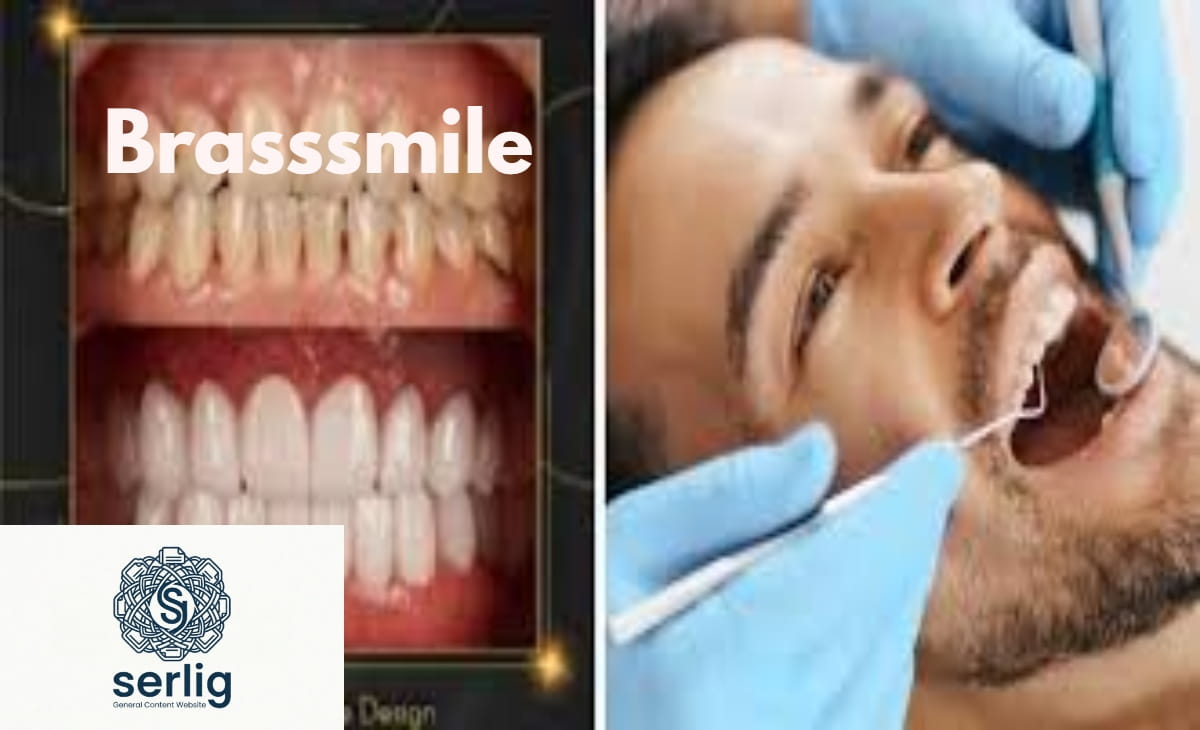 BrassSmile dental transformation — before and after brassy teeth treatment